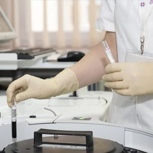 Strontium Tungstate -200 Mesh | Spectrum Chemicals Australia
