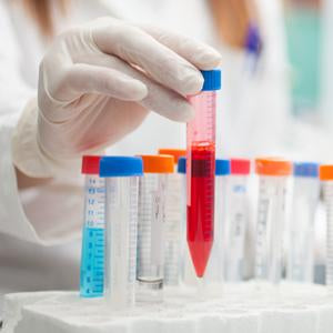 Ammonium Bisulfate Crystal Reagent | Spectrum Chemicals Australia